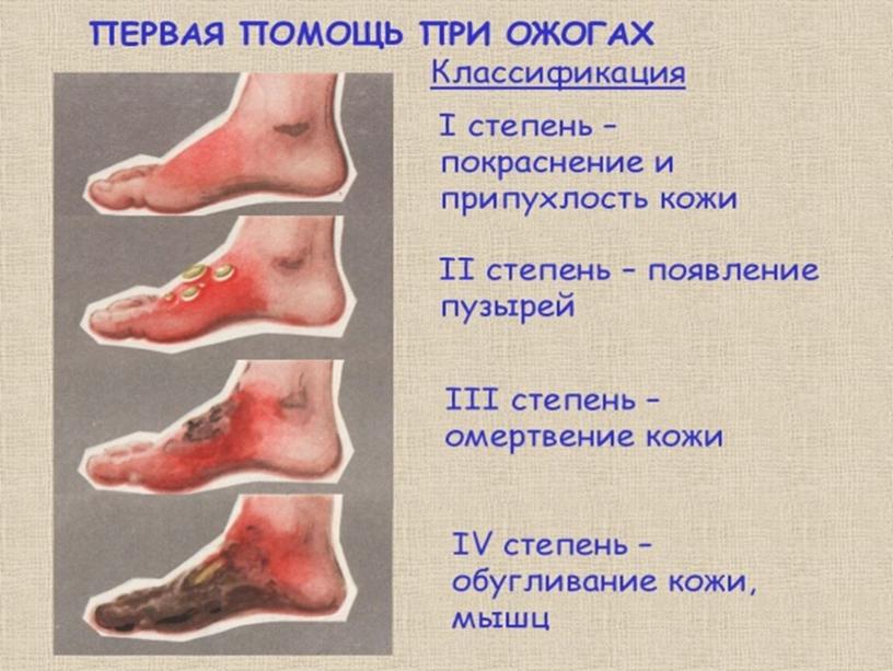 Доврачебная помощь и особенности проведения реанимационных мероприятий