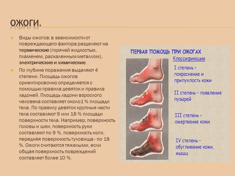 Ожоги. Виды ожогов: в зависимости от повреждающего фактора разделяют на термические (горячей жидкостью, пламенем, раскаленным металлом), электрические и химические