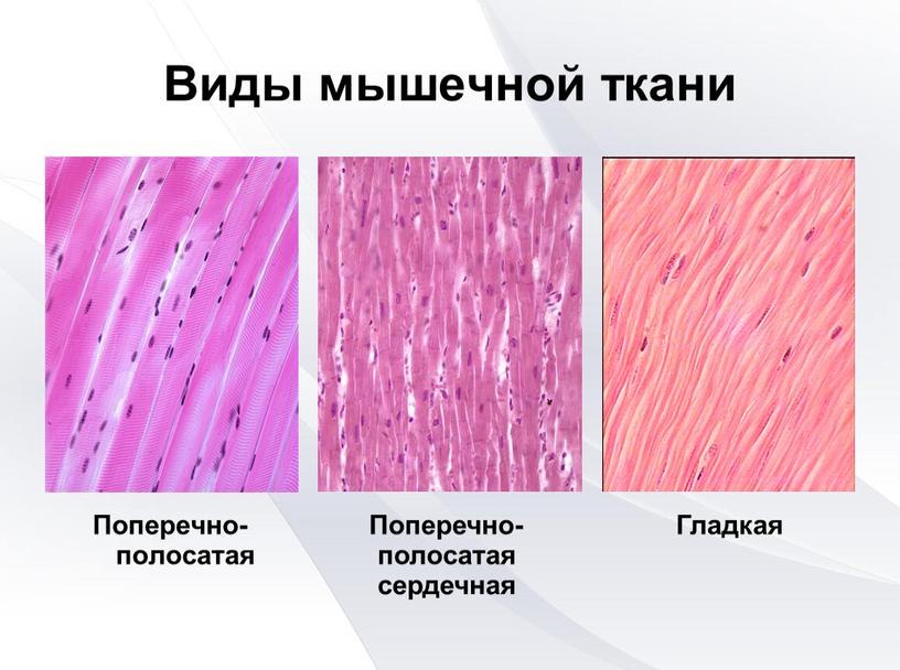 Виды мышечной ткани Поперечно-полосатая