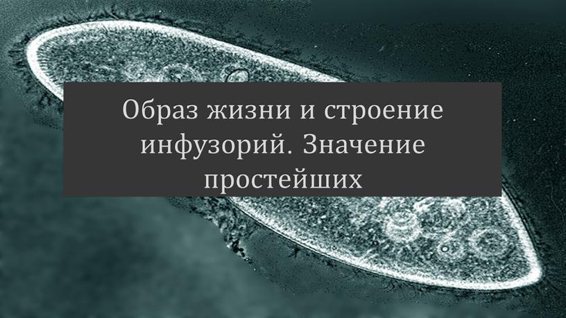 Образ жизни и строение инфузорий