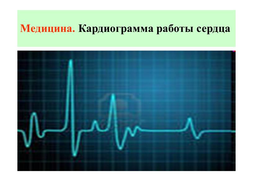 Медицина. Кардиограмма работы сердца