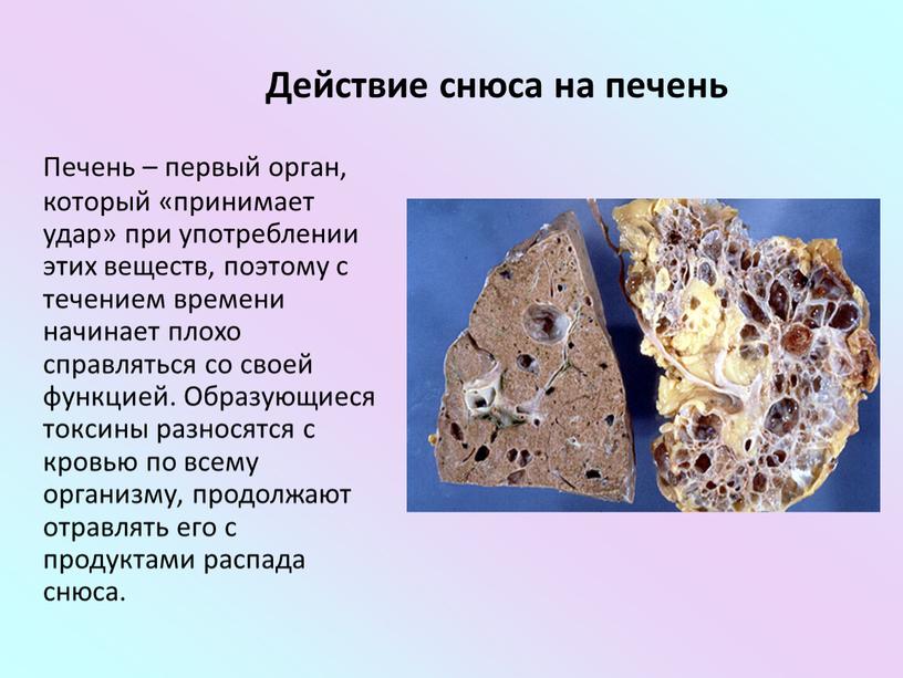 Действие снюса на печень Печень – первый орган, который «принимает удар» при употреблении этих веществ, поэтому с течением времени начинает плохо справляться со своей функцией