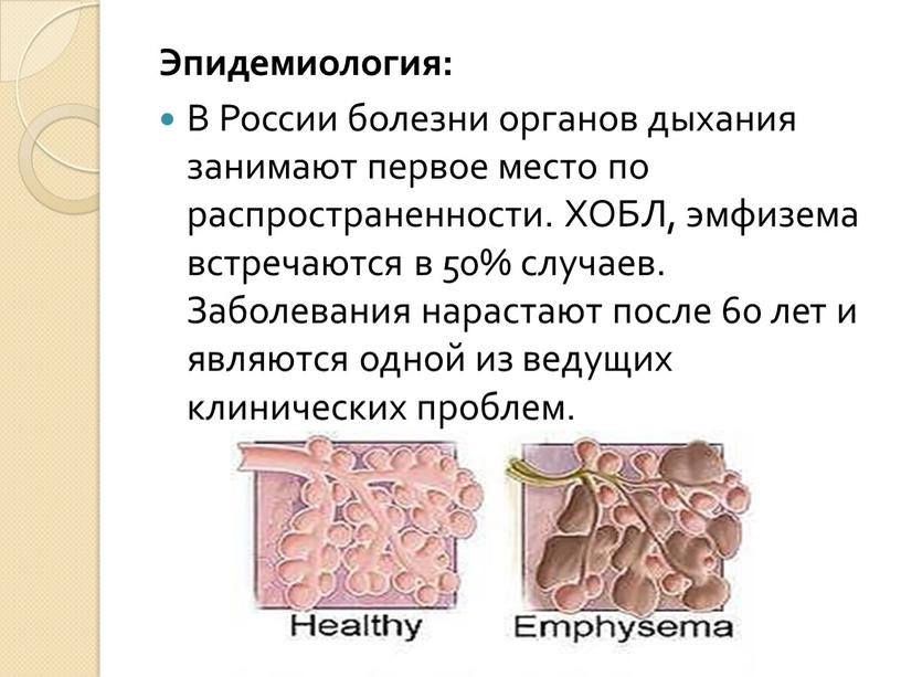 Эпидемиология: В России болезни органов дыхания занимают первое место по распространенности