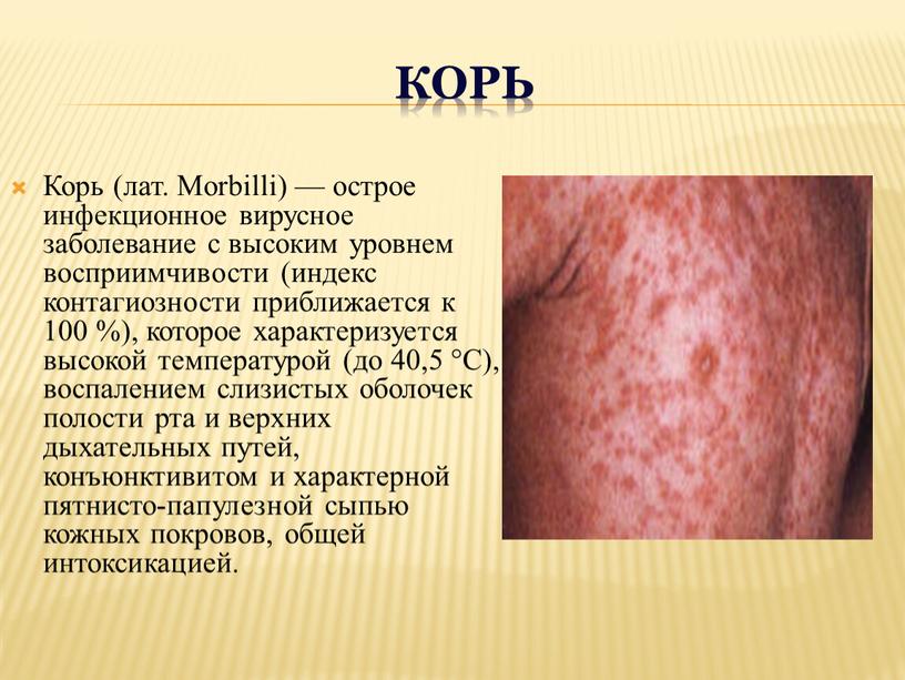 КОРЬ Корь (лат. Morbilli) — острое инфекционное вирусное заболевание с высоким уровнем восприимчивости (индекс контагиозности приближается к 100 %), которое характеризуется высокой температурой (до 40,5…