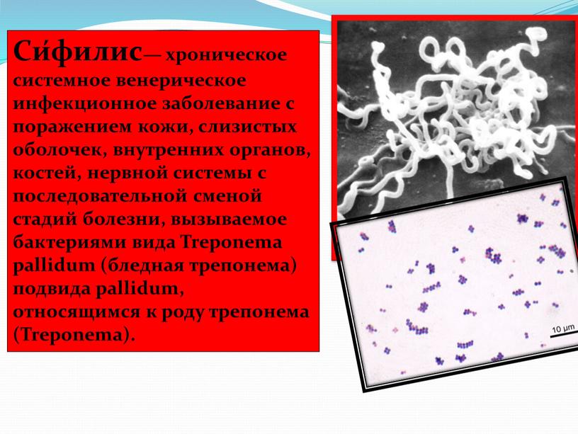 Си́филис— хроническое системное венерическое инфекционное заболевание с поражением кожи, слизистых оболочек, внутренних органов, костей, нервной системы с последовательной сменой стадий болезни, вызываемое бактериями вида