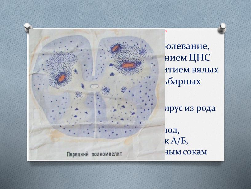 ПОЛИОМИЕЛИТ – острое инфекционное заболевание, характеризующееся поражением