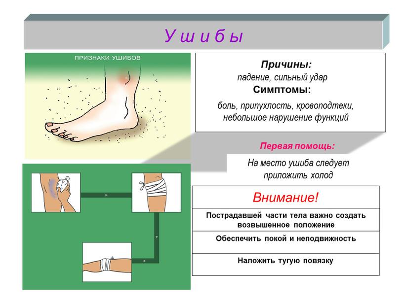 У ш и б ы Внимание! падение, сильный удар