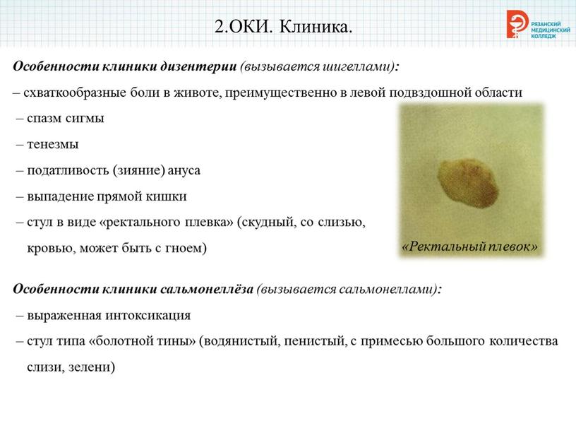 ОКИ. Клиника. Особенности клиники дизентерии (вызывается шигеллами) : – схваткообразные боли в животе, преимущественно в левой подвздошной области – спазм сигмы – тенезмы – податливость…