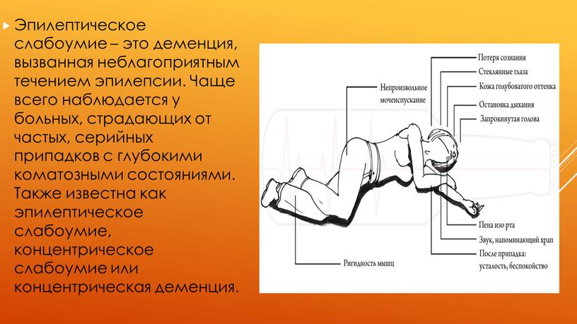 Эпилептическое слабоумие – это деменция, вызванная неблагоприятным течением эпилепсии