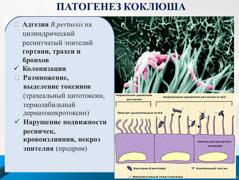 ПАТОГЕНЕЗ КОКЛЮША  Адгезия B