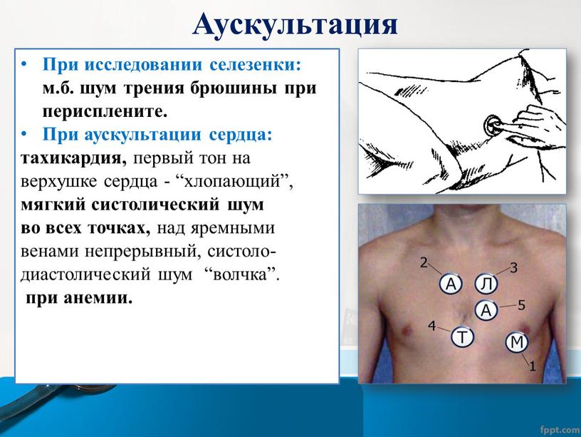 Аускультация При исследовании селезенки: м