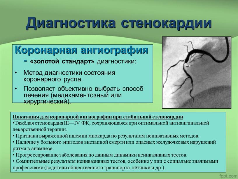 Диагностика стенокардии Коронарная ангиография - «золотой стандарт» диагностики: