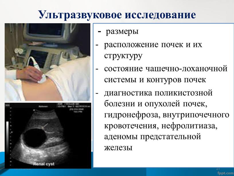 18.04.2022 21 - размеры расположение почек и их структуру состояние чашечно-лоханочной системы и контуров почек диагностика поликистозной болезни и опухолей почек, гидронефроза, внутрипочечного кровотечения, нефролитиаза,…