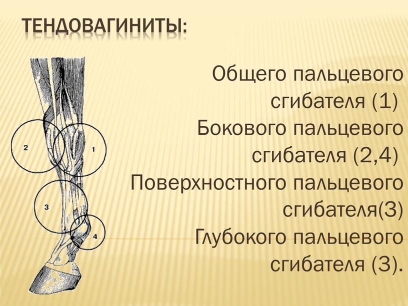 Общего пальцевого сгибателя (1)