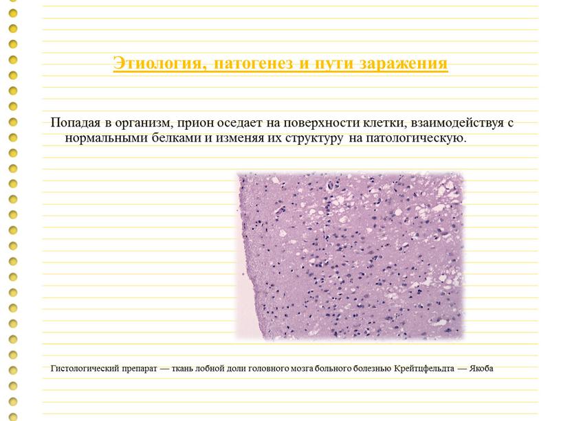 Этиология, патогенез и пути заражения