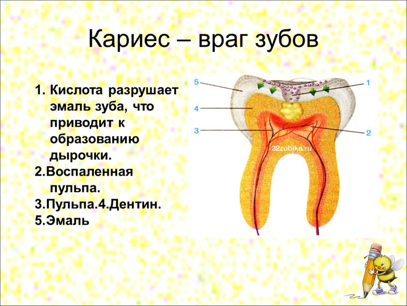 Кариес – враг зубов Кислота разрушает эмаль зуба, что приводит к образованию дырочки