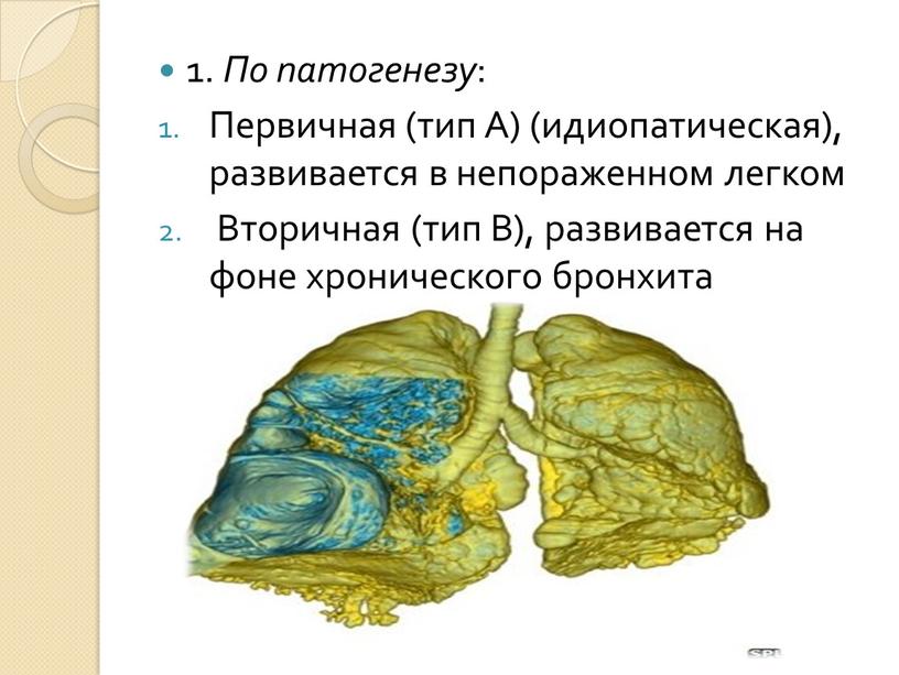 По патогенезу : Первичная (тип