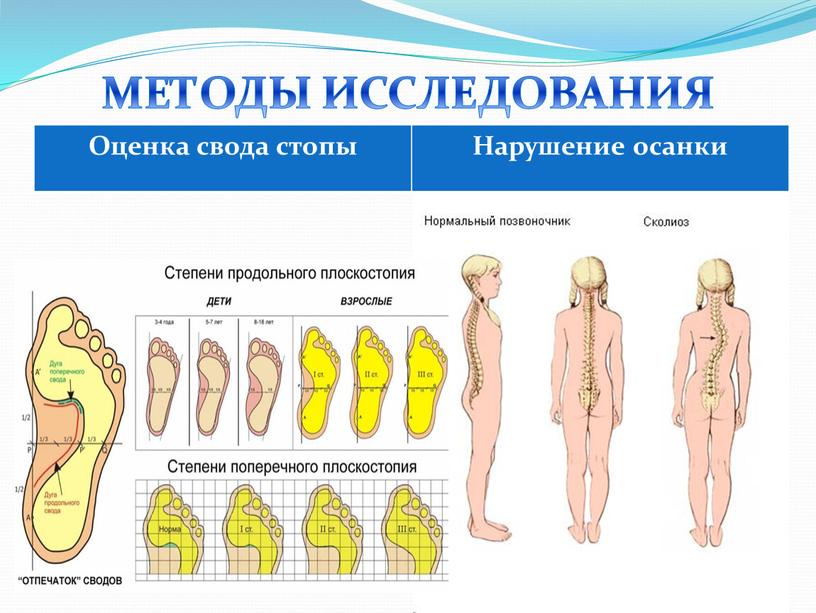 МЕТОДЫ ИССЛЕДОВАНИЯ Оценка свода стопы