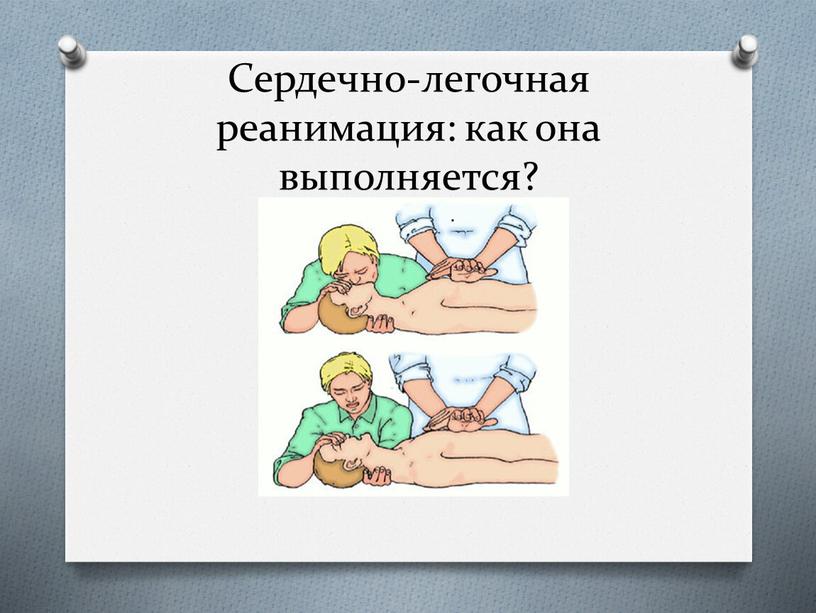 Сердечно-легочная реанимация: как она выполняется?