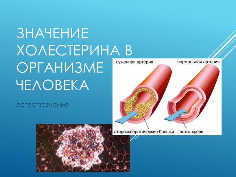 Значение холестерина в организме человека естествознание