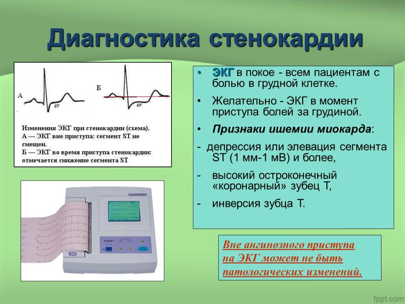 Диагностика стенокардии ЭКГ в покое - всем пациентам с болью в грудной клетке