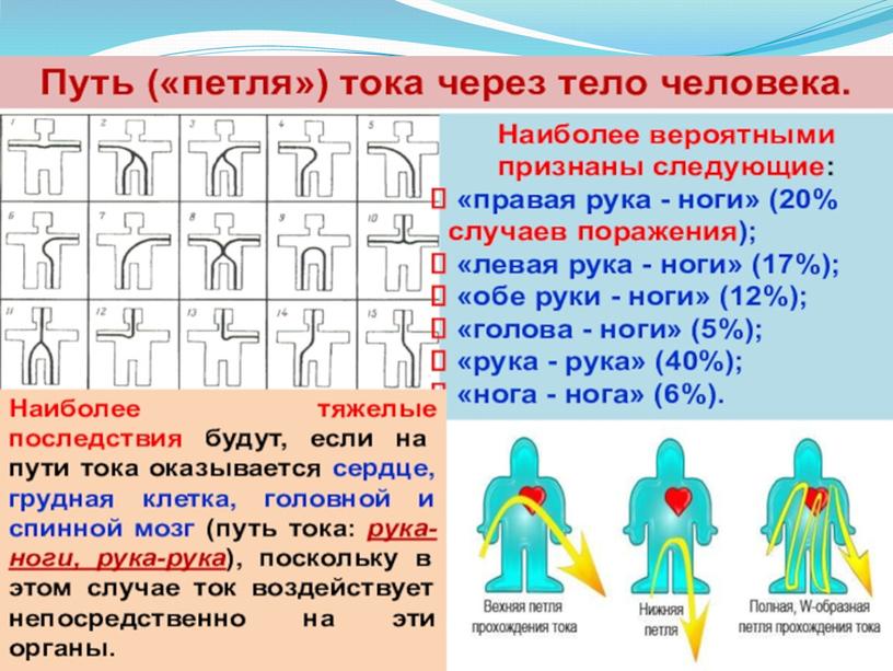 Презентация "Электротравма" для занятий по МБО БЖ для СПО