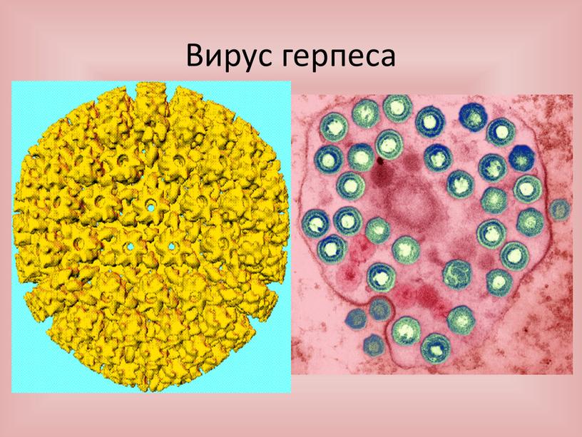 Вирус герпеса