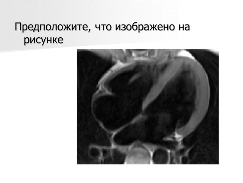 Предположите, что изображено на рисунке