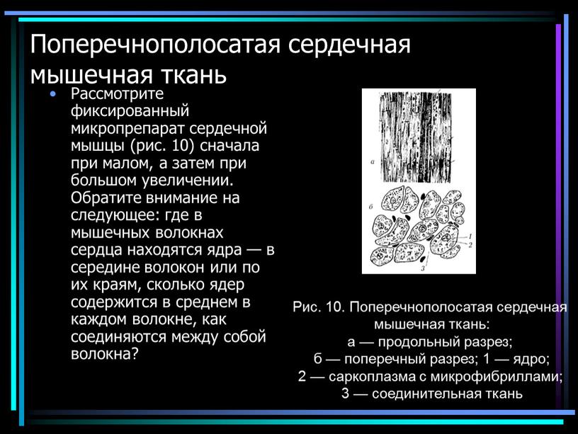 Поперечнополосатая сердечная мышечная ткань