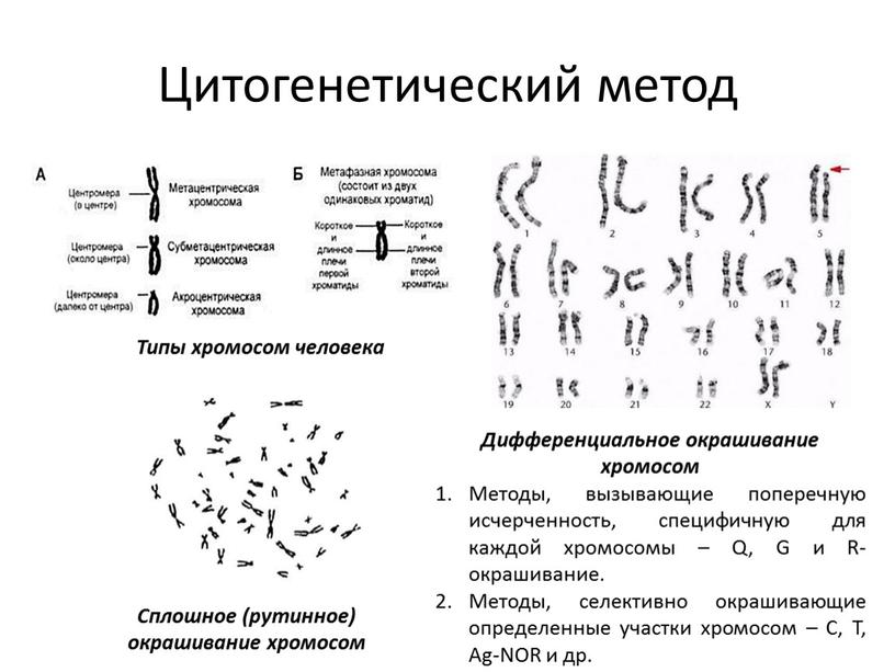 Цитогенетический метод Типы хромосом человека