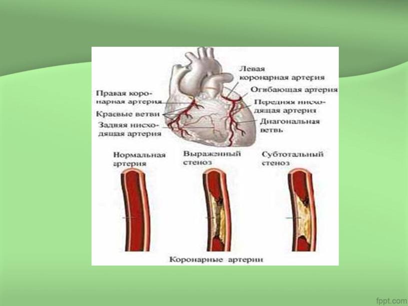 ОБУЧАЮЩАЯ ПРЕЗЕНТАЦИЯ "СП при ИБС, стенокардии"