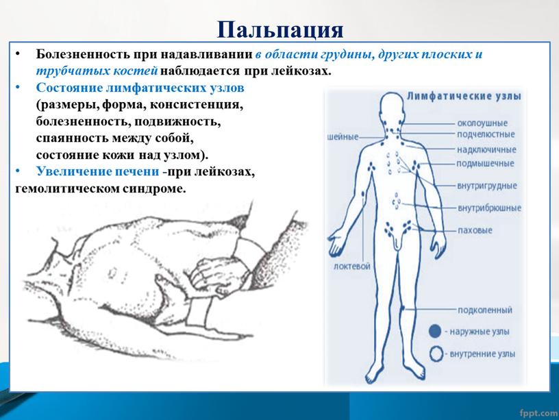 Пальпация Болезненность при надавливании в области грудины, других плоских и трубчатых костей наблюдается при лейкозах