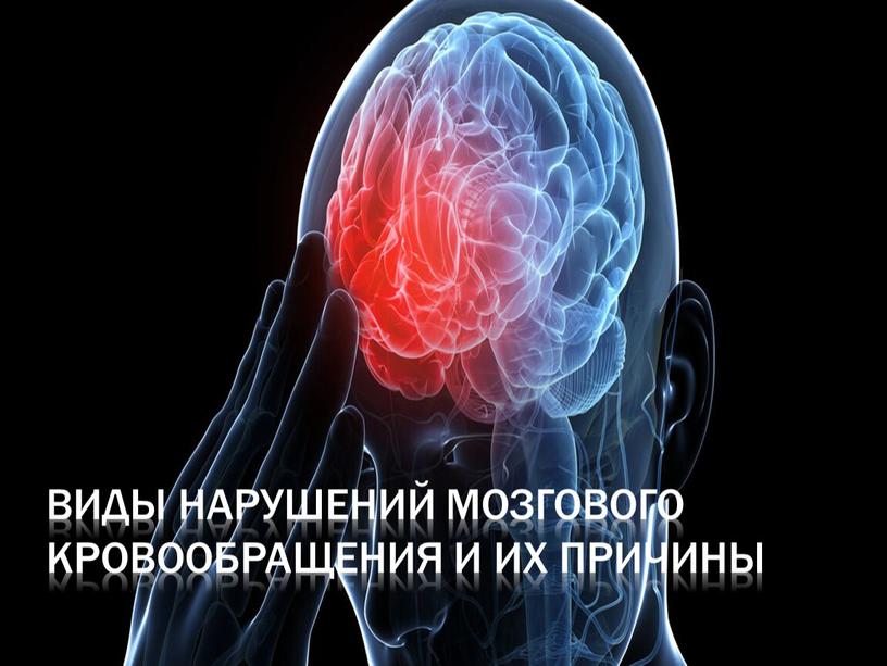 Виды нарушений мозгового кровообращения и их причины