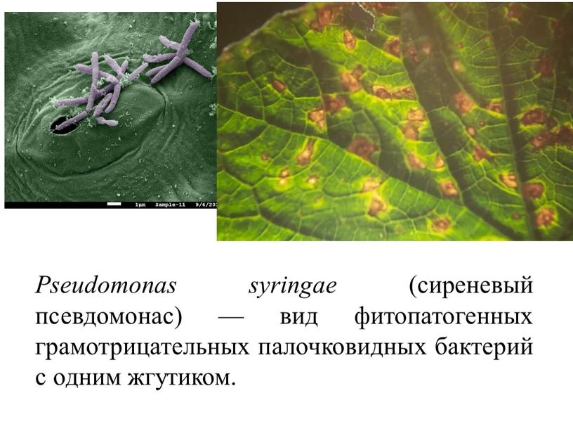 Pseudomonas syringae (сиреневый псевдомонас) — вид фитопатогенных грамотрицательных палочковидных бактерий с одним жгутиком