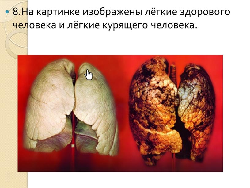 На картинке изображены лёгкие здорового человека и лёгкие курящего человека