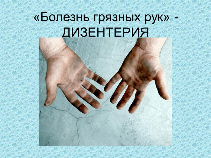 Болезнь грязных рук» - ДИЗЕНТЕРИЯ