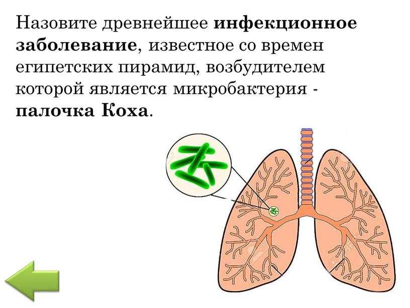 Назовите древнейшее инфекционное заболевание , известное со времен египетских пирамид, возбудителем которой является микробактерия - палочка