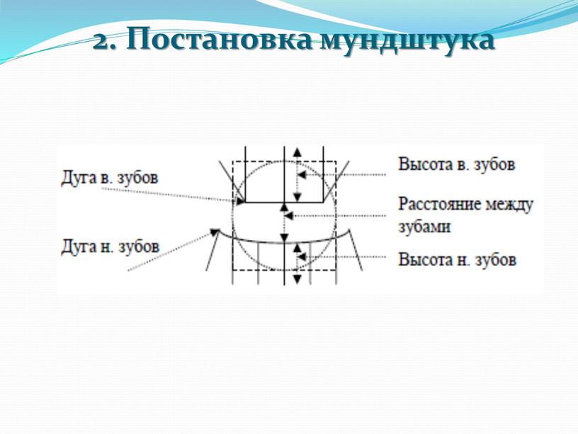 2. Постановка мундштука