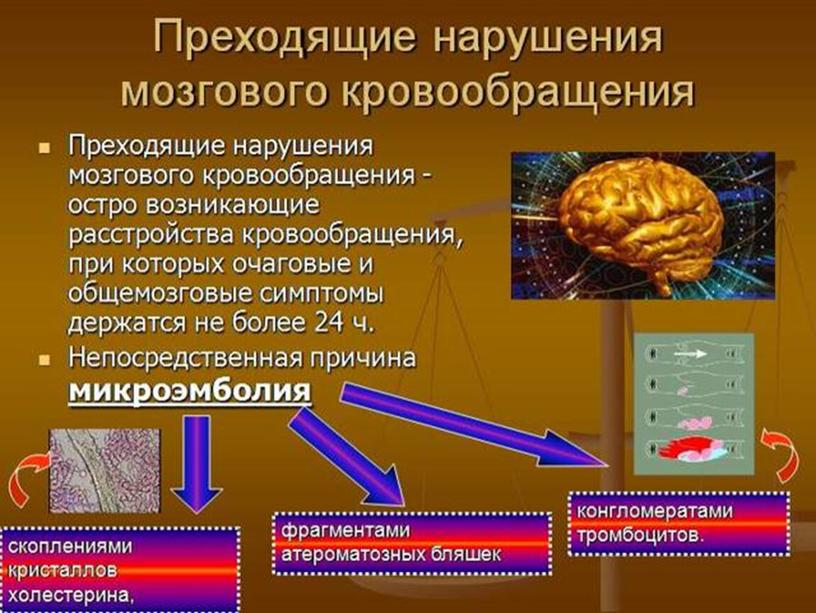 Виды нарушений мозгового кровообращения и их причины