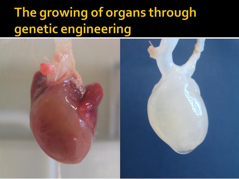 The growing of organs through genetic engineering