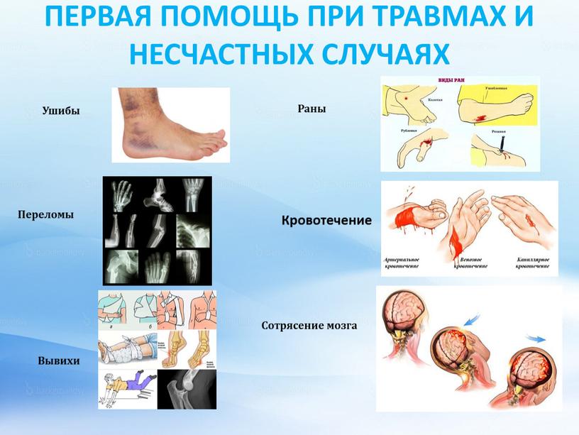 ПЕРВАЯ ПОМОЩЬ ПРИ ТРАВМАХ И НЕСЧАСТНЫХ