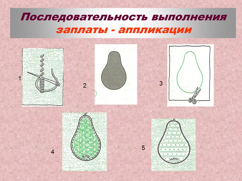 Последовательность выполнения заплаты - аппликации 1 2 3 4 5