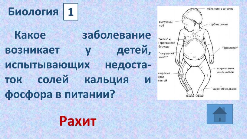 Биология 1 Какое заболевание возникает у детей, испытывающих недоста-ток солей кальция и фосфора в питании?