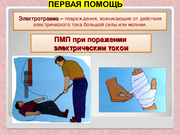Ожоги обж 9 класс презентация