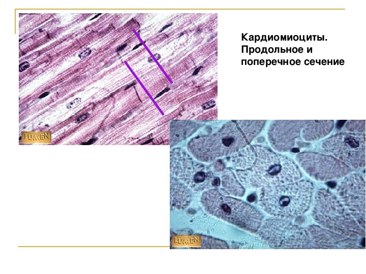 Атипичные кардиомиоциты рисунок