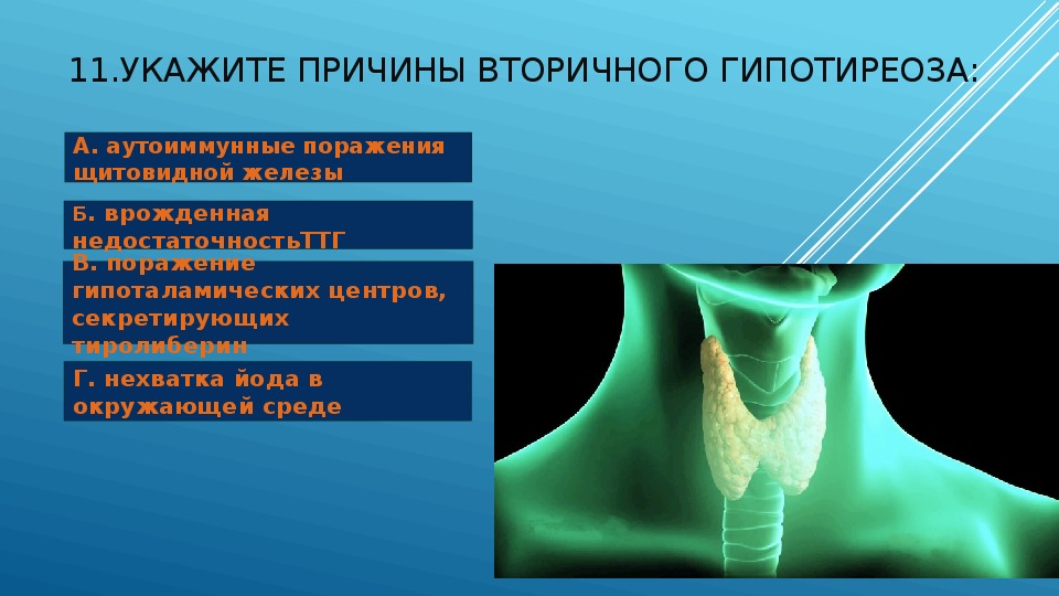 Гипотиреоз щитовидки это. Эндемический зоб гипотиреоз. Укажите причины гипотиреоза. Презентация на тему гипотиреоз. Щитовидная железа при гипотиреозе.