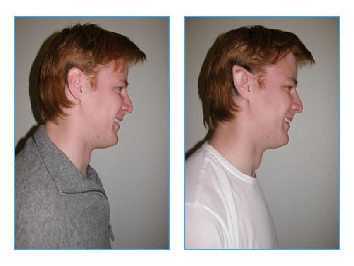 Характер по форме ушей у мужчин с фото
