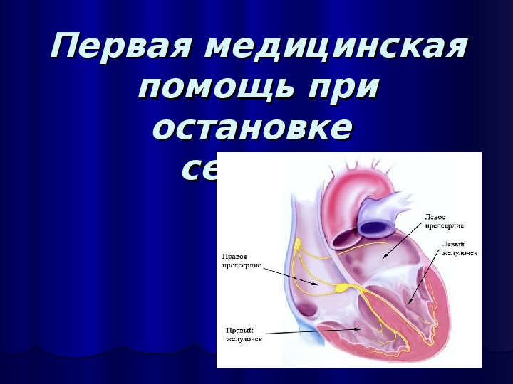 Презентация "Первая медицинская помощь при остановке сердца"