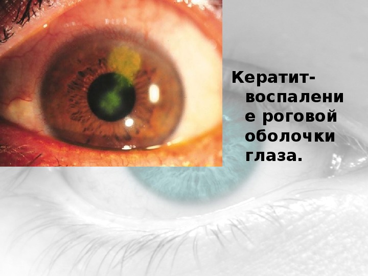 Болезни глаз (8 класс)