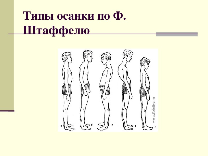 Рассмотрите рисунки 1 4 с изображением типов осанок человека как называют нарушение осанки